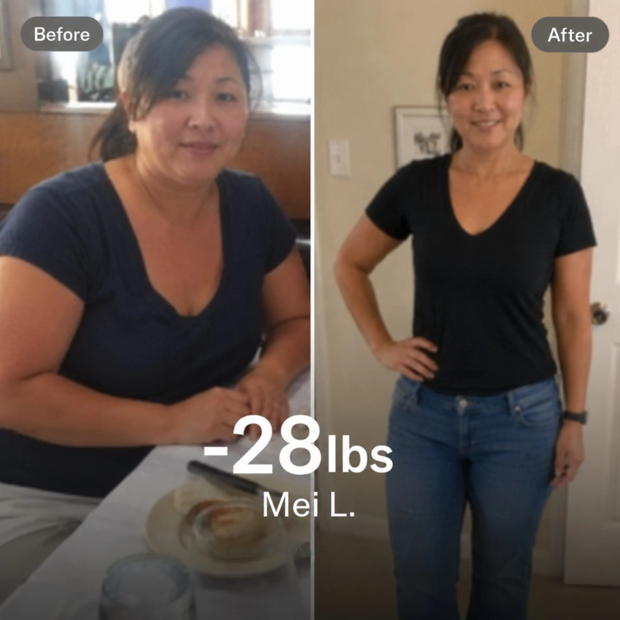Mei L. before and after